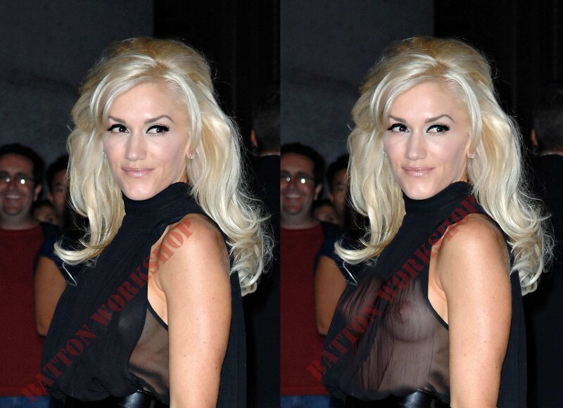 Gwen Stefani x-ray 01 picture