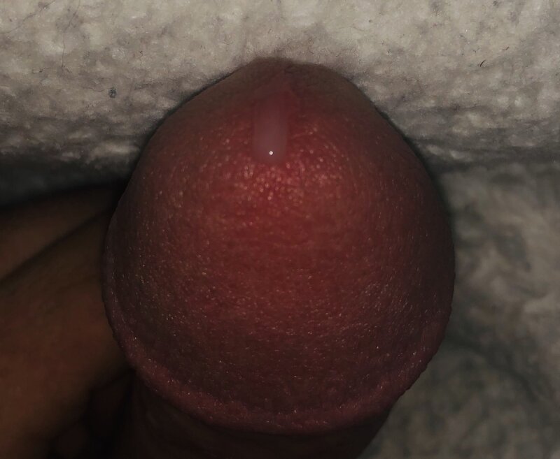 Edging leakage picture