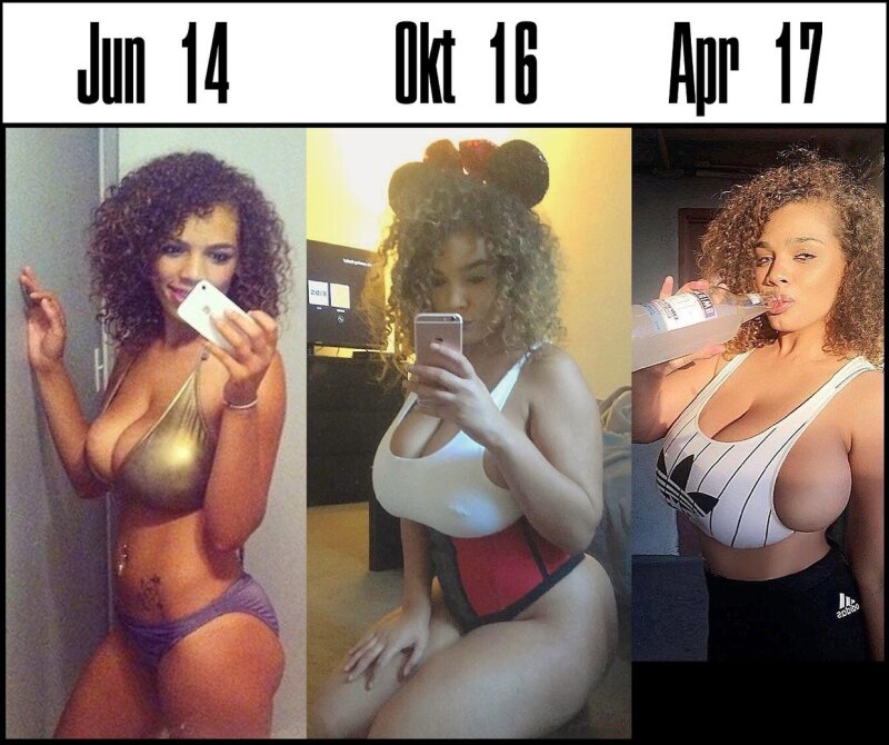 Breast Growth picture