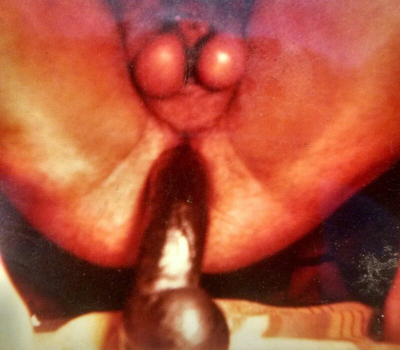 Yapay penis picture