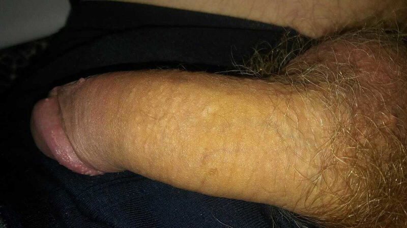 Sex18 picture