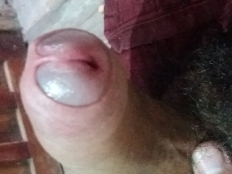 Üst picture