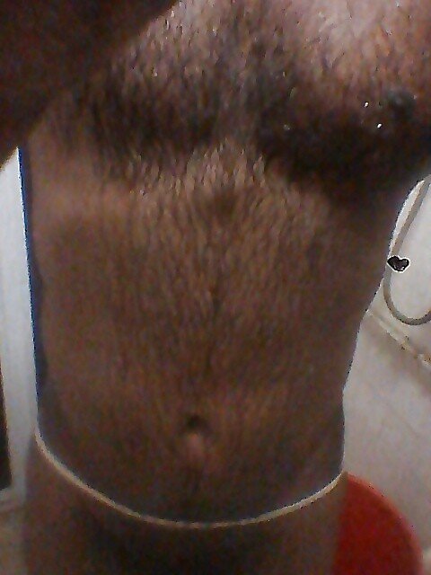 my hairy body picture