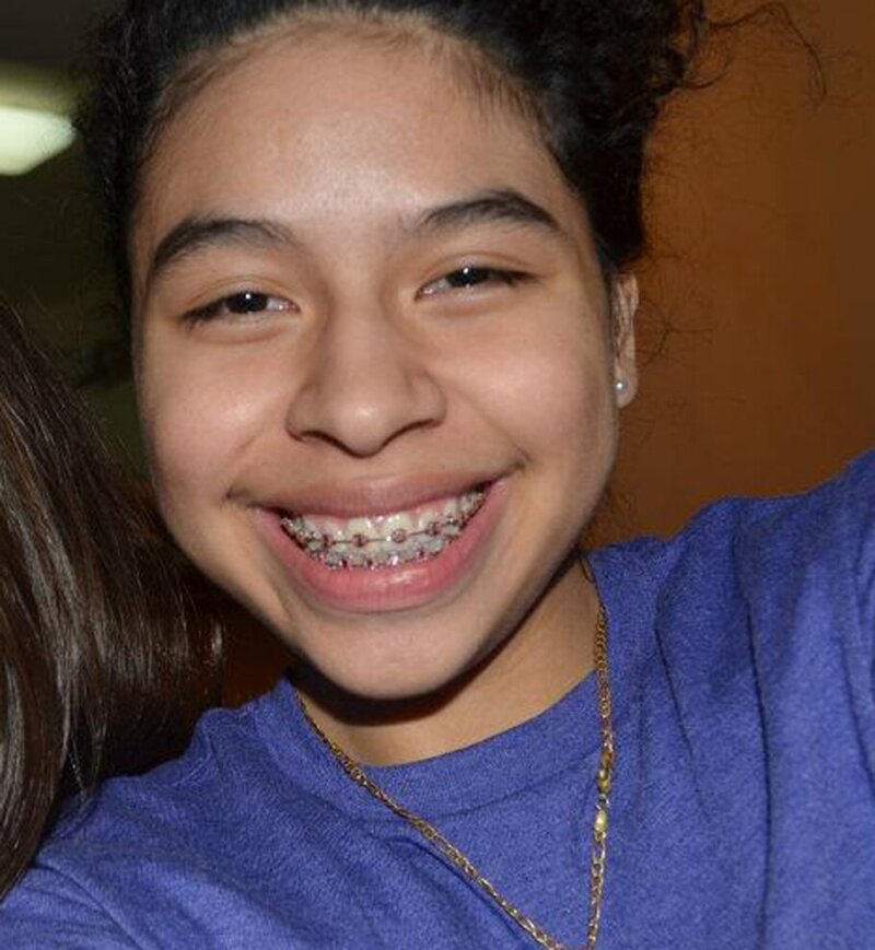 smiling with braces picture