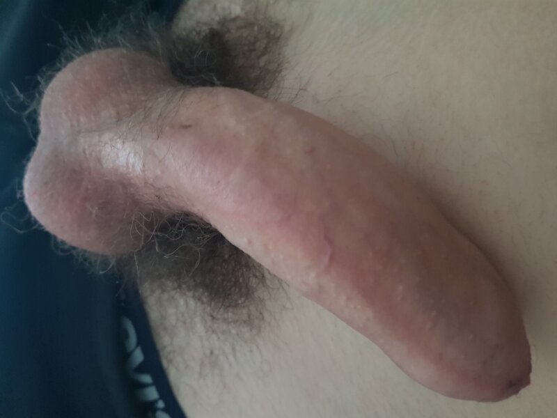 My hairy heavyset balls and 18 cm cock picture