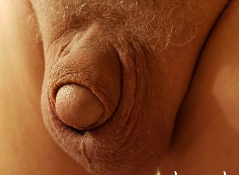 My Small Penis picture