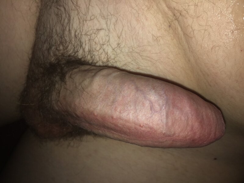 Uncircumcised dick picture