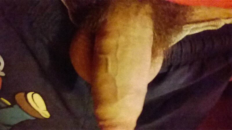 my penis picture