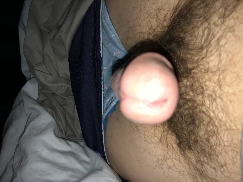 Penis picture
