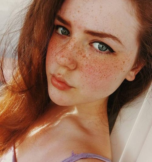 freckles picture