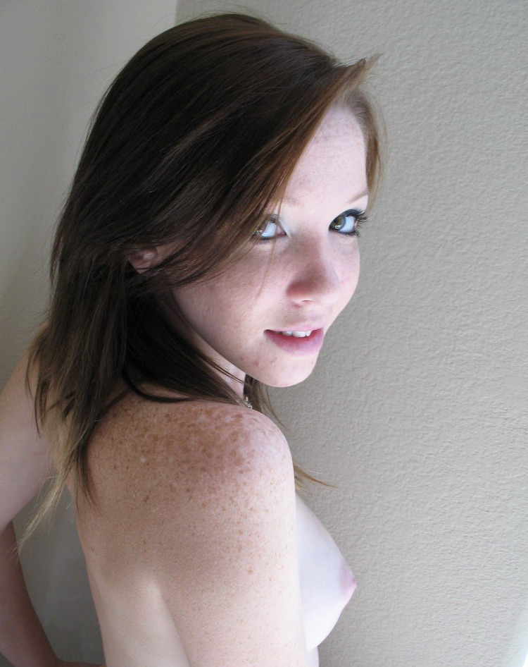 Freckles picture