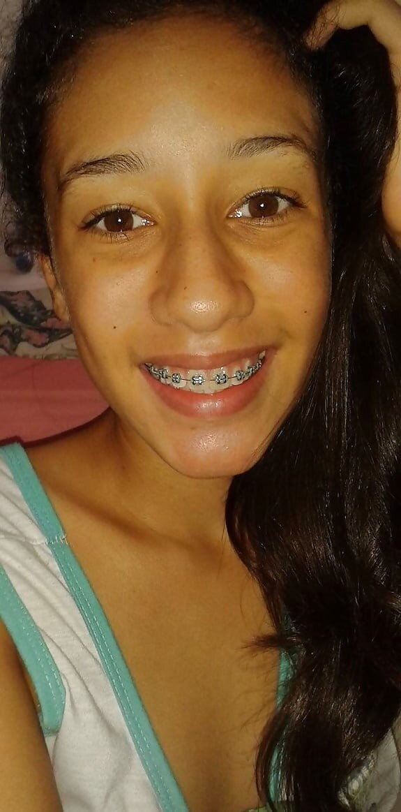Brezilyalı genç gülümseyen diş telleri picture