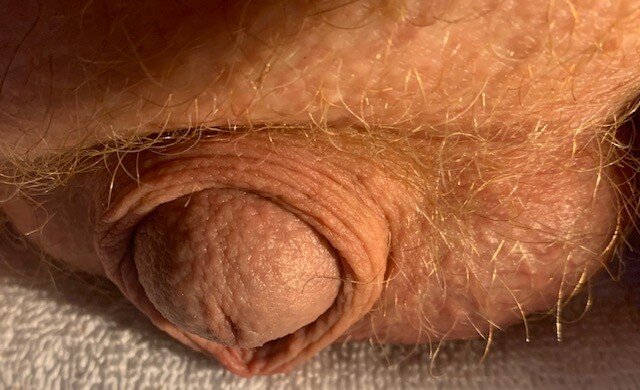 乳头的家伙 picture