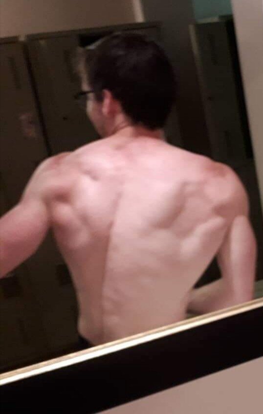 My back picture