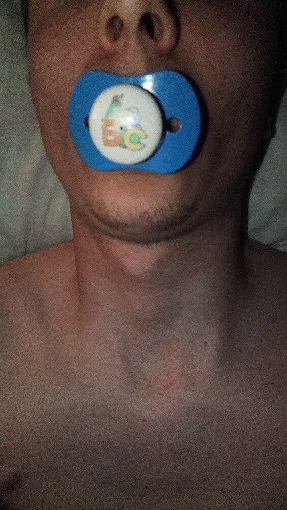 Me sucking my childhood's pacifier picture