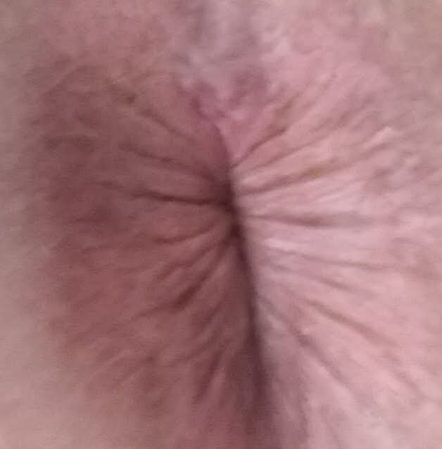 My asshole closeup picture