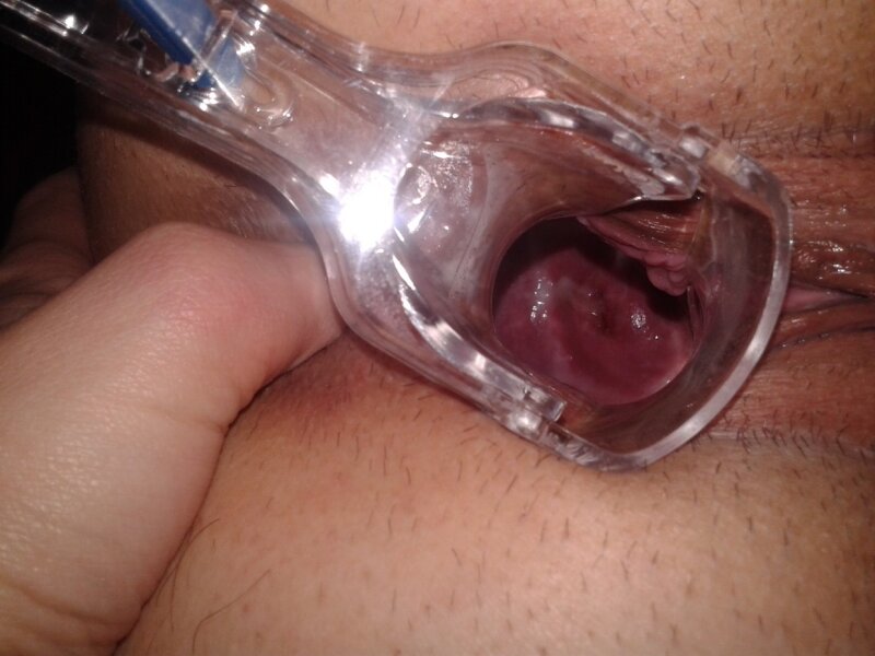 Close Up vagina picture