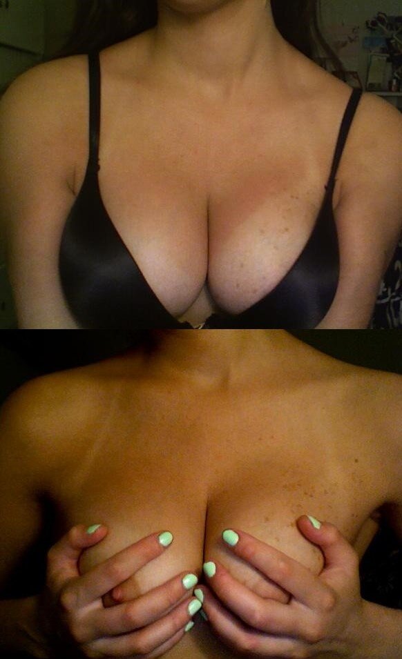 Before and after wife tits picture