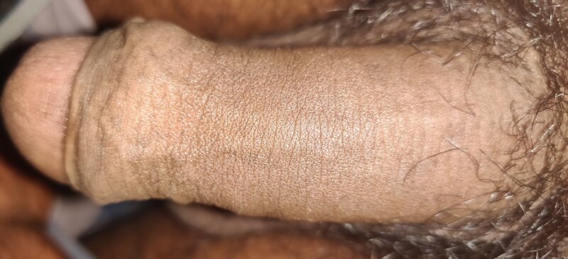It's hairy skinny too picture