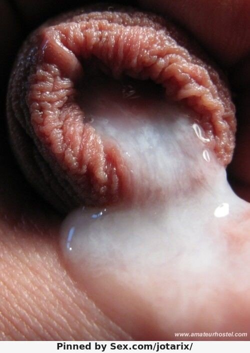 foreskin ooze picture