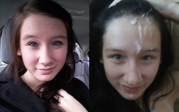 cute teen before after facial picture