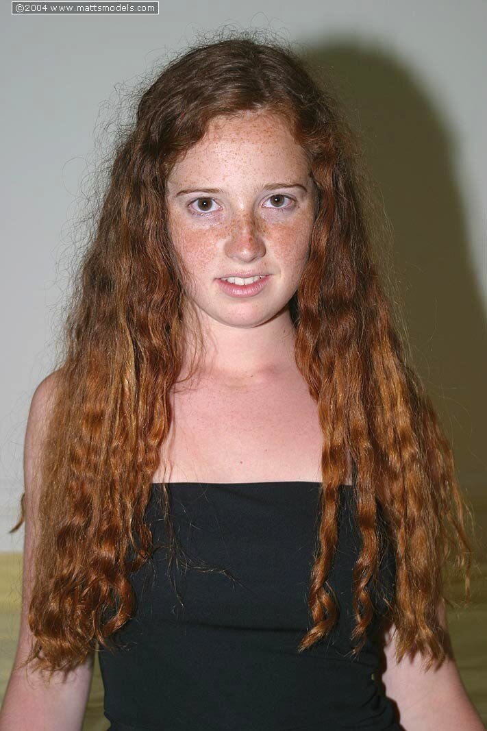 Freckled Red-head picture