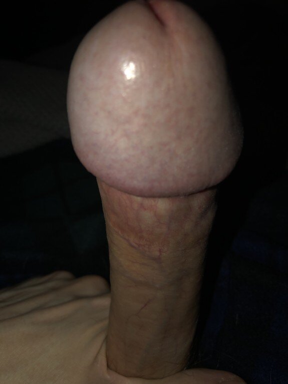 My head, swollen and shiny. It needs some huge titties to fuck. picture