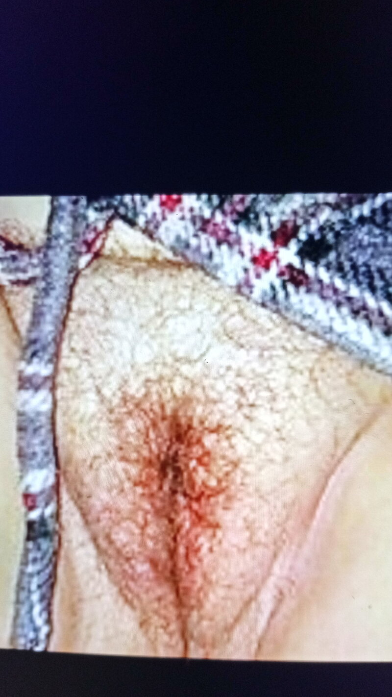 내 털이 음부를 먹어 picture