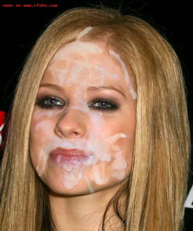 Avril Lavigne massive facial picture