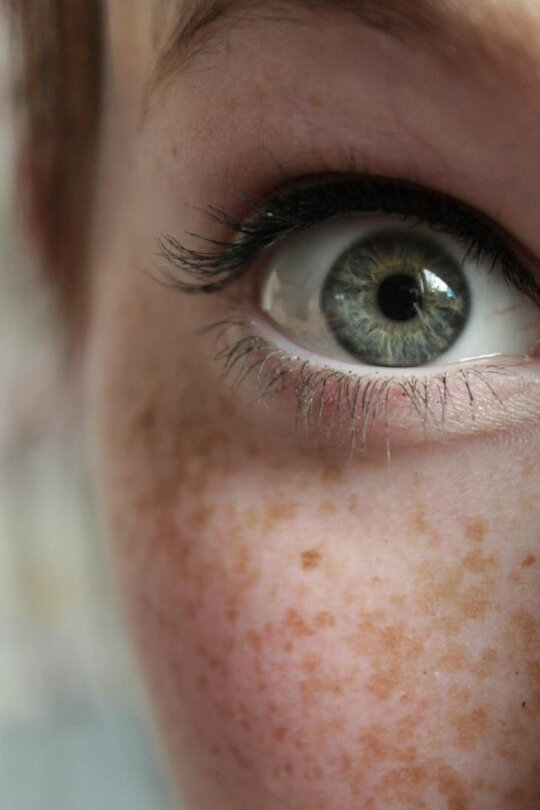 green eyed freckled chick picture