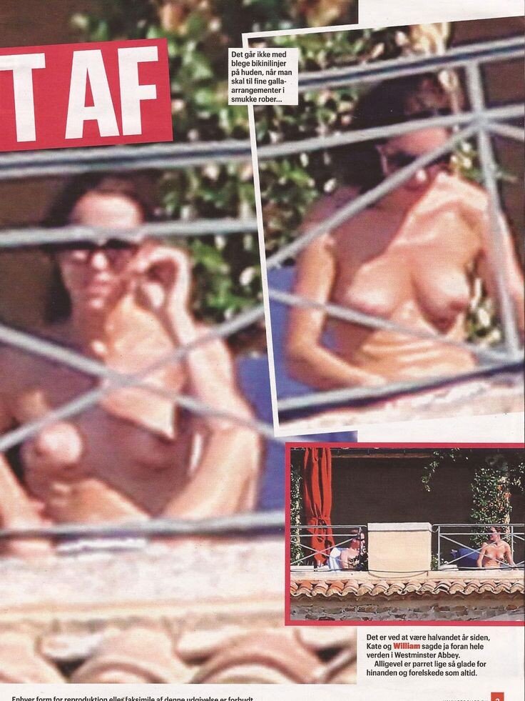 Princess kate middleton topless picture