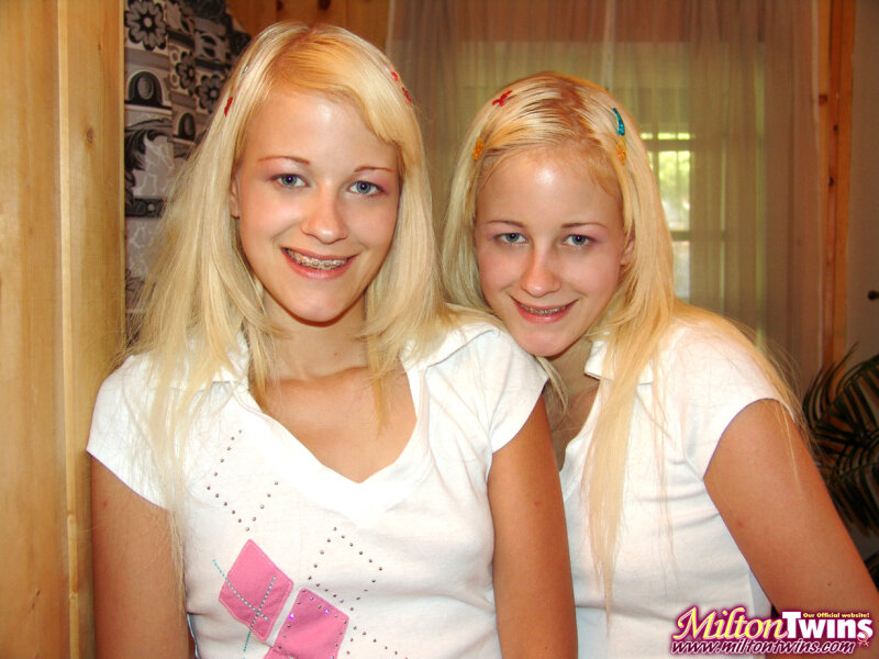 Milton Twins - Braces picture