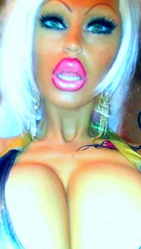 Barbie Jade has crazy huge plush plump bimbo lips - weird shit - fota lipz weirdd picture