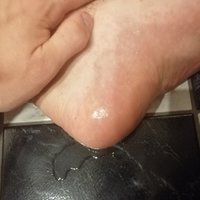  Foot Fetish  pics