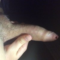  Penis Personal  pics