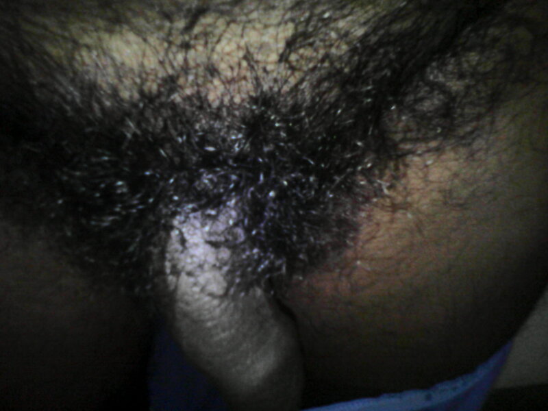 kapat picture