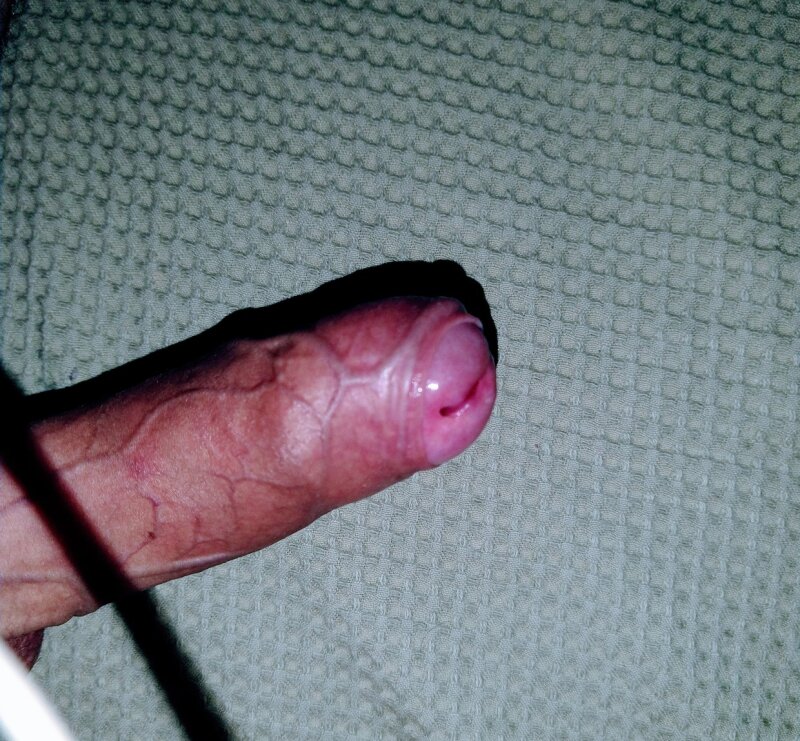 迪克1 picture