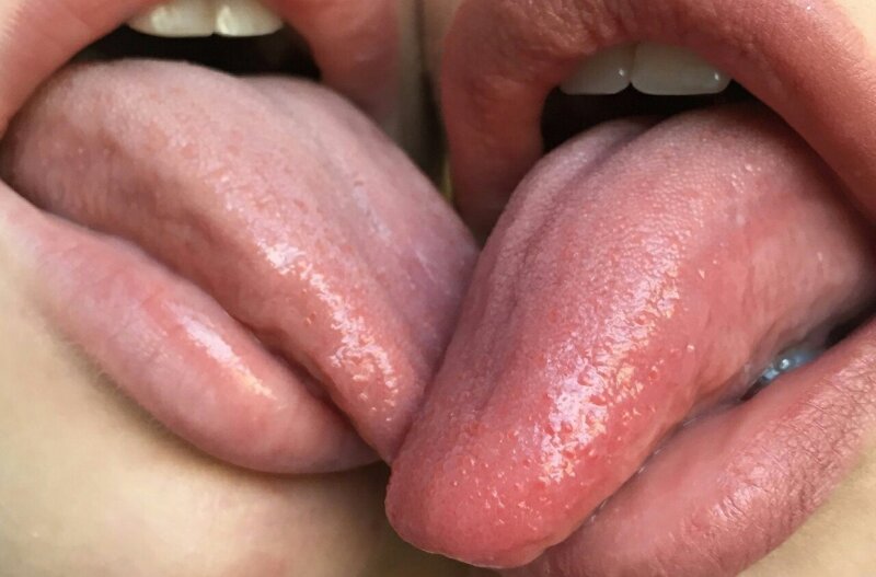 キス picture