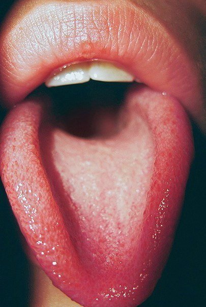 뜨거운 그림 picture