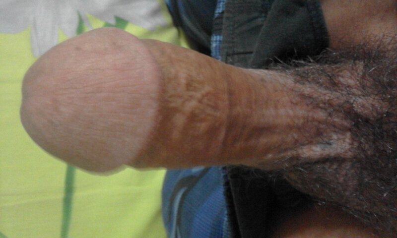 我的 picture