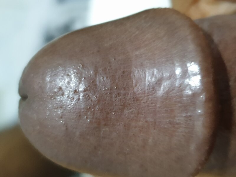 デカチン picture