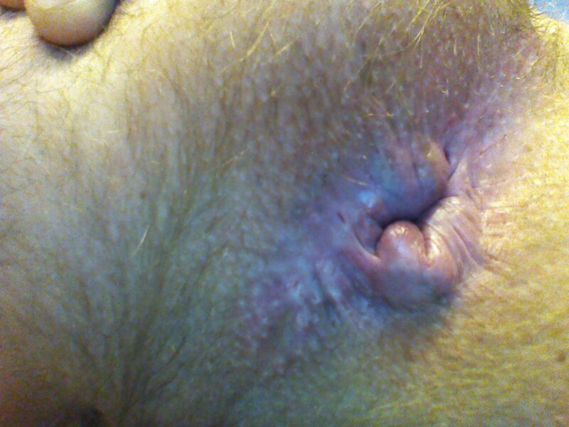 关闭 picture