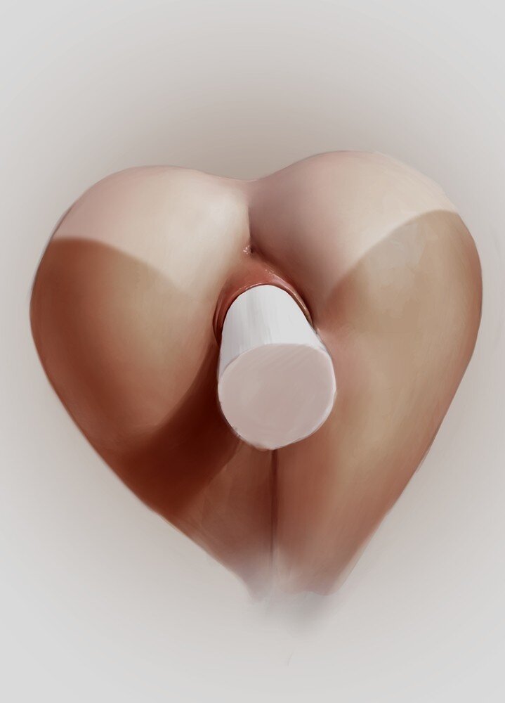来自Albasnipple picture