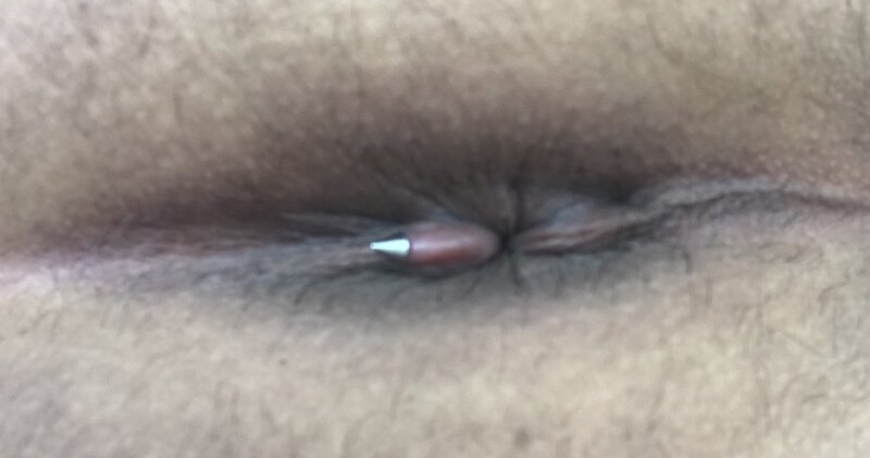 항문 피어싱 picture