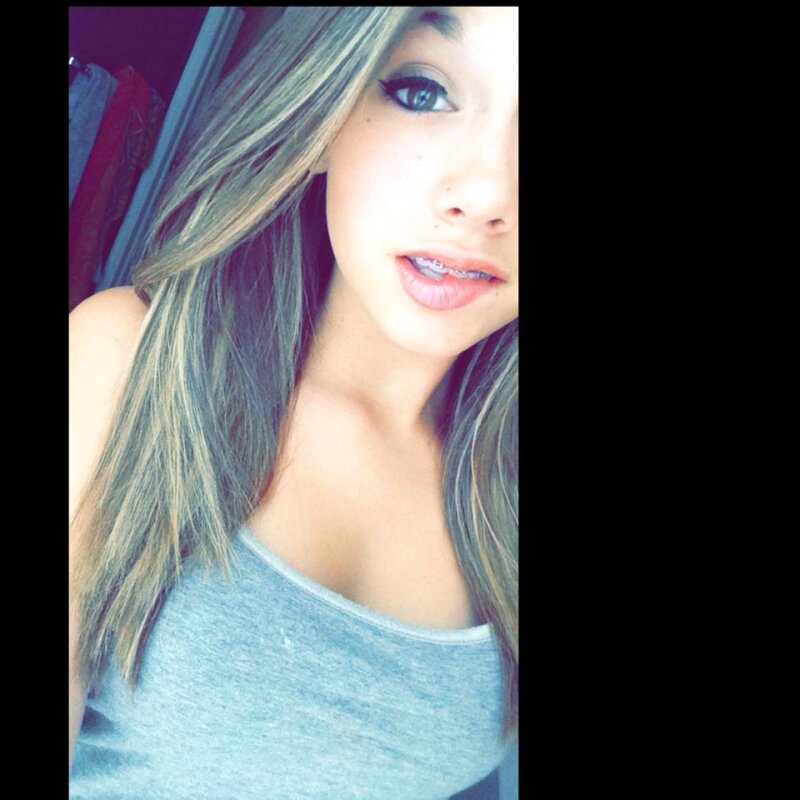 このティーン、それらの中括弧が大好きです!!! picture