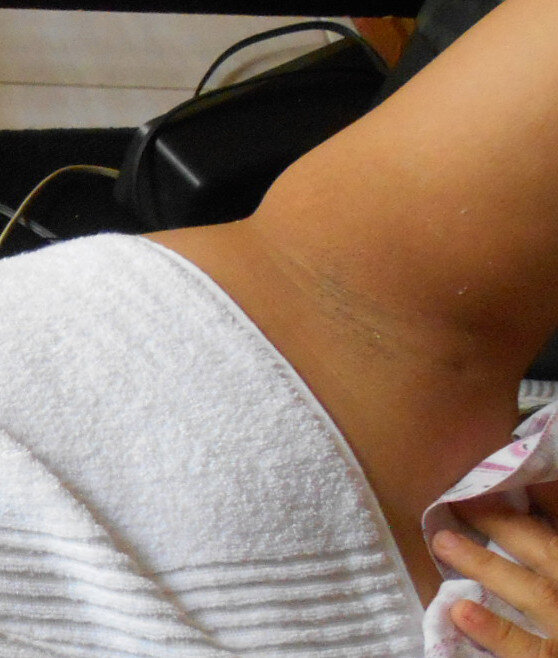 女性腋窝 picture